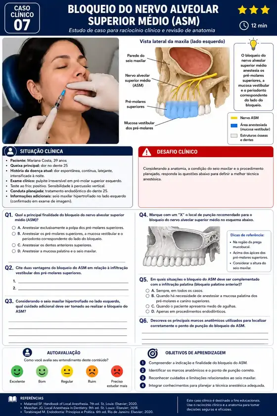 Caso Clínico 07 — Bloqueio do Nervo Alveolar Superior Médio (ASM)